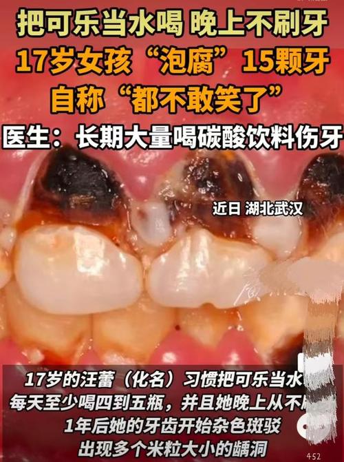 喝完可樂可以刷牙嗎