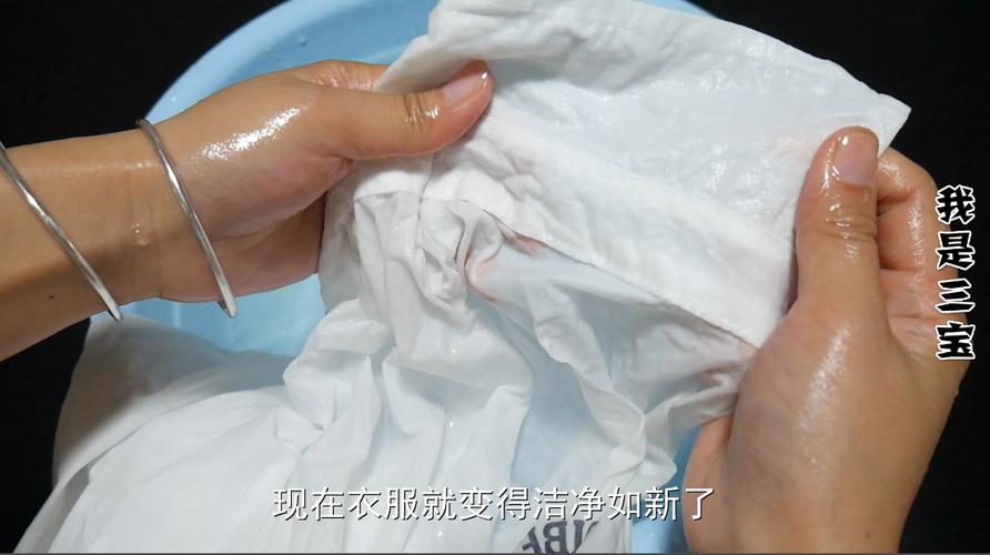 為什麼領口會黃