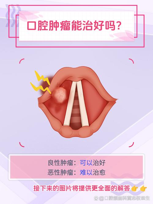 口腔癌治的好嗎:深入解析治療、預後與康復之路 1 口腔癌治的好嗎