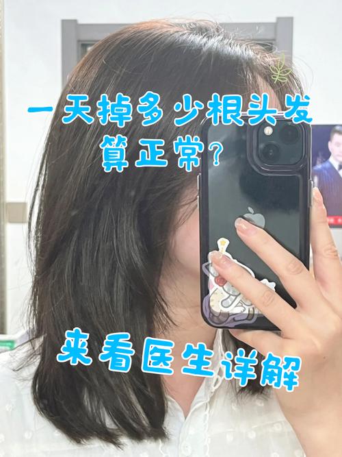 一日正常甩幾多條頭髮:認識你的掉髮量與頭髮健康 3 一日正常甩幾多條頭髮
