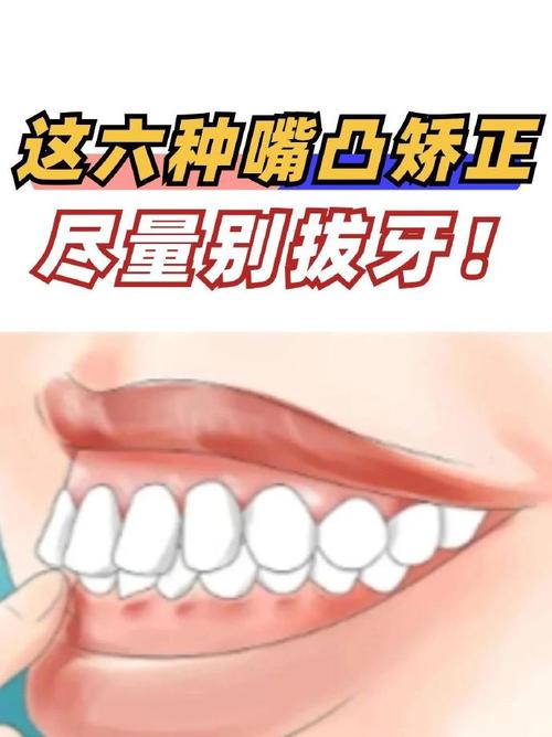 不拔牙可以改善嘴凸嗎