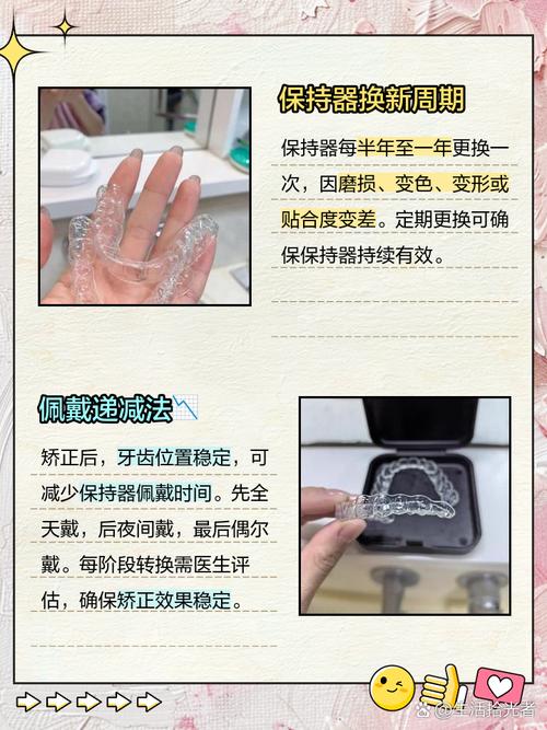 維持器不見了怎麼辦:矯正救急指南,從尋找、替代到重新製作的完整解決方案 3 維持器不見了怎麼辦