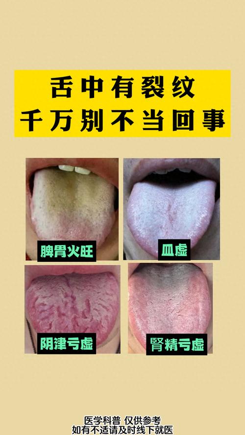 舌頭破洞吃什麼