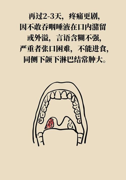 扁桃腺切除會痛嗎