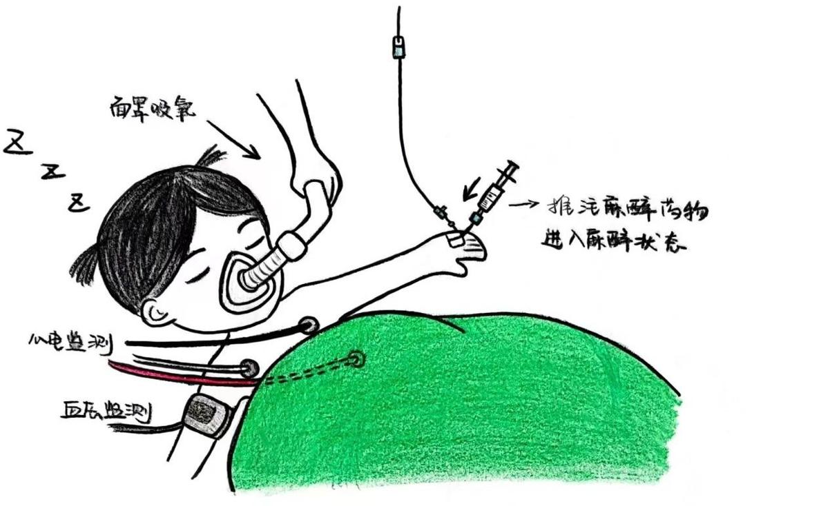 小孩可以全身麻醉嗎:兒童麻醉的安全、考量與家長須知 3 小孩可以全身麻醉嗎