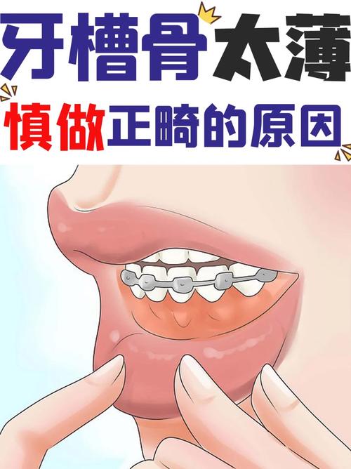 為什麼牙齒會移位