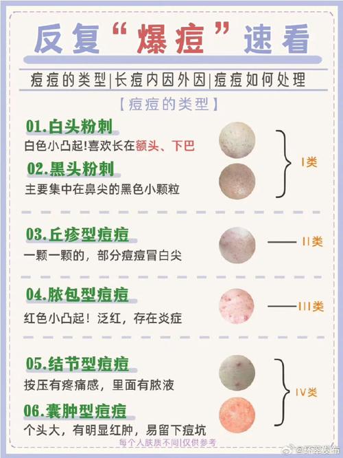 碘伏可以擦痘痘嗎:全面解析碘伏用於痘痘的效益與風險 3 碘伏可以擦痘痘嗎