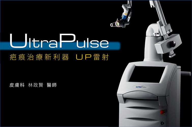 up雷射多久打一次?UP雷射施打頻率、間隔與療程規劃深度解析 3 up雷射多久打一次