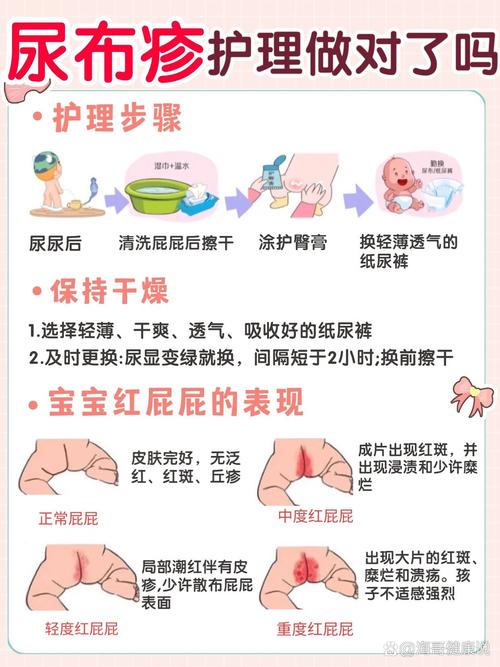 尿布疹擦什麼