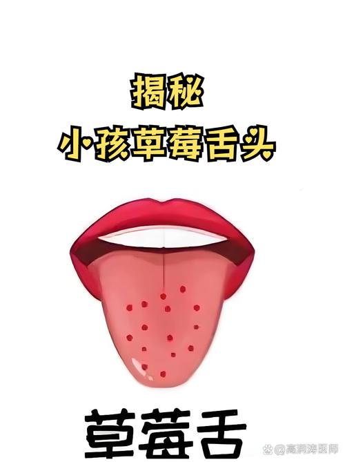 舌頭發炎多久會好