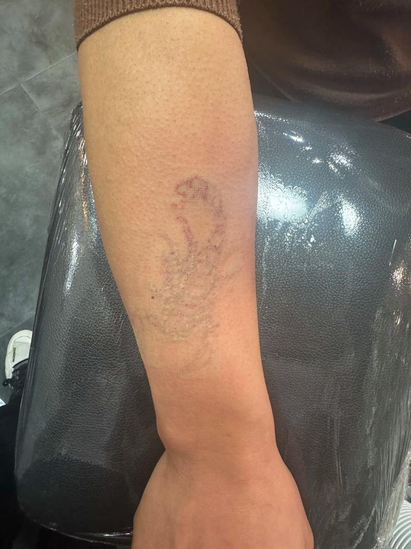 刺青完可以擦什麼