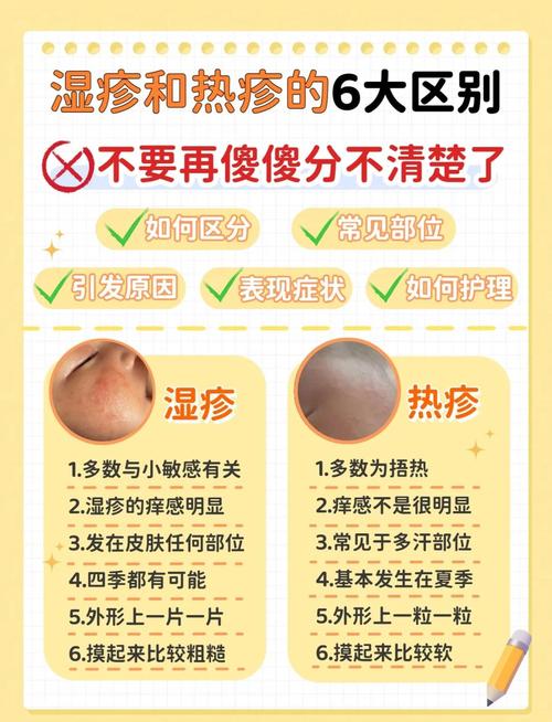 如何分辨熱疹:從症狀、成因到居家護理的完整指南 1 如何分辨熱疹