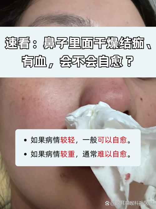 為什麼鼻子一直過敏