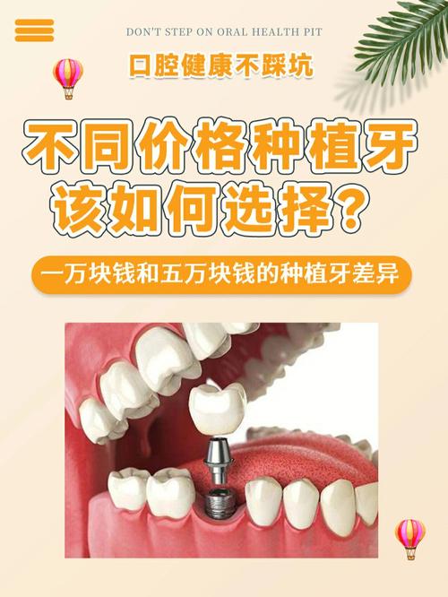 植牙為什麼那麼貴