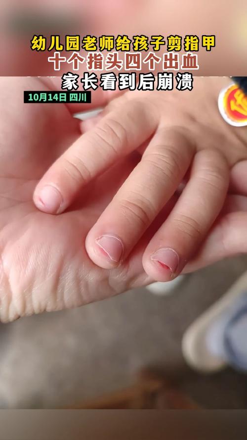 晚上剪指甲會怎樣