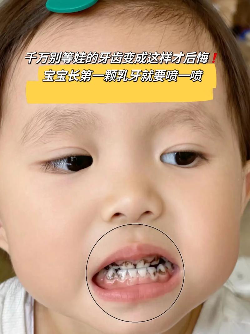 夜奶要刷牙嗎