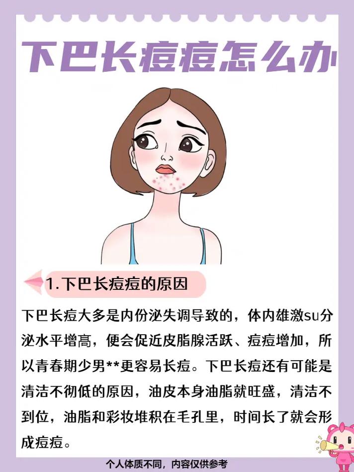 為什麼下巴一直長粉刺