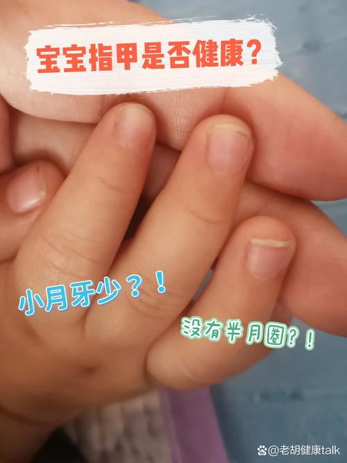 沒有月牙會怎樣