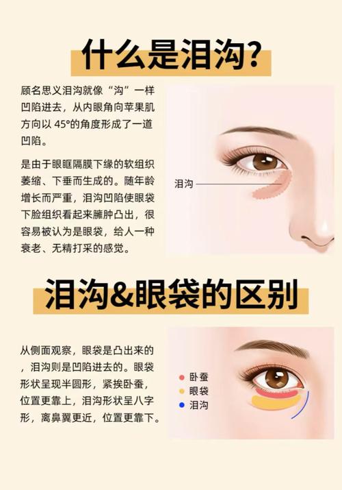 淚溝是天生的嗎