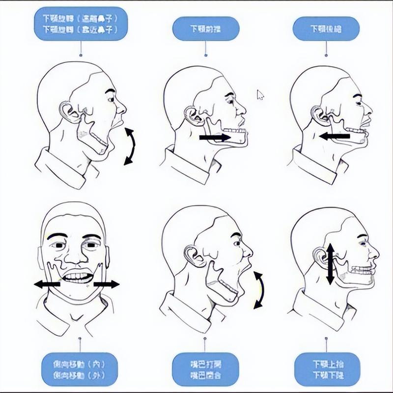 下巴脫臼會自己好嗎