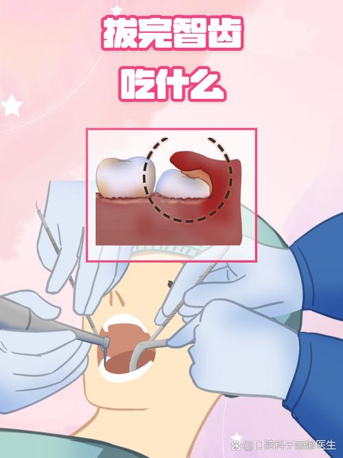 拔智齒為什麼要吞口水