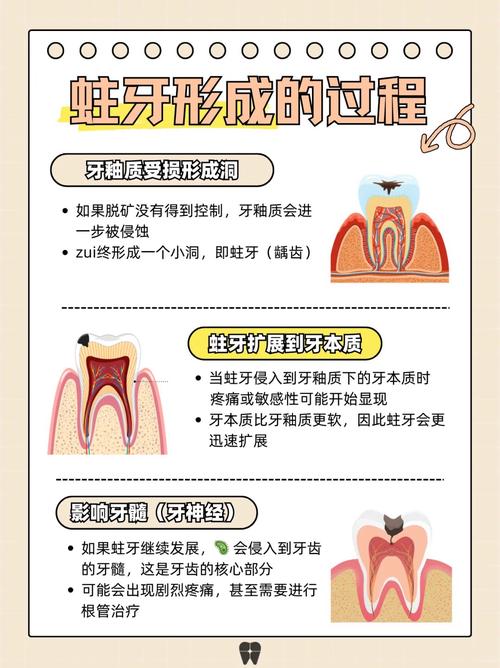 蛀牙為什麼會臭
