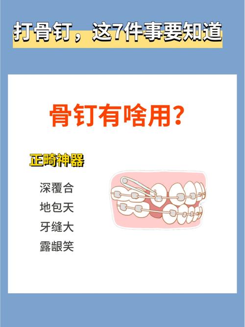 骨釘一根多少錢