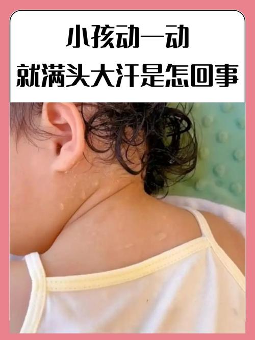 為什麼頭很容易流汗