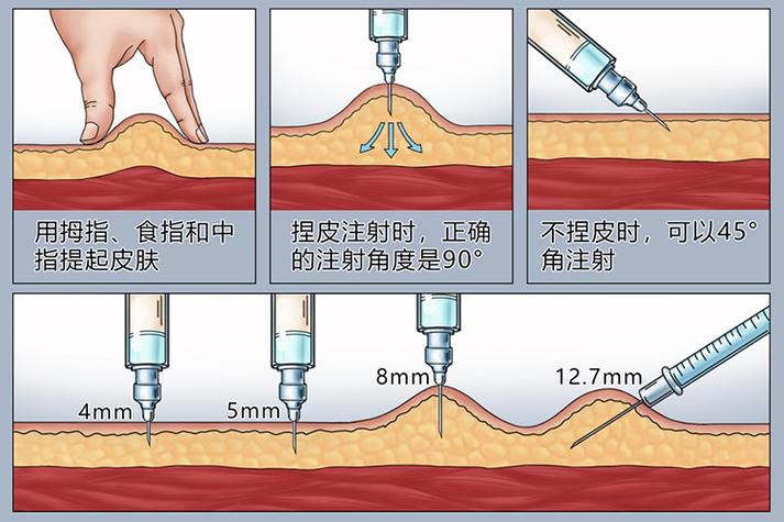 為什麼打針要壓
