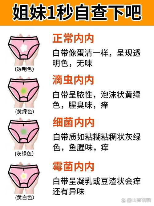 私密處搔癢擦什麼:從止癢、舒緩到根本解決的全面指南 3 私密處搔癢擦什麼