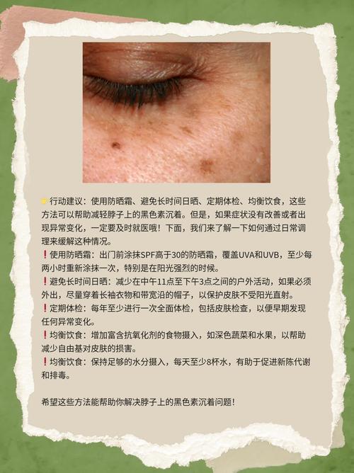 黑色素沈澱可以擦什麼