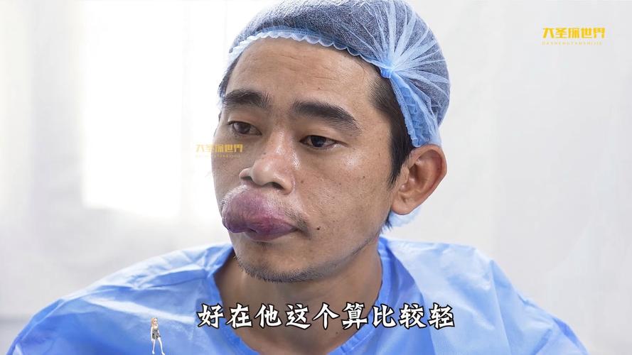 接吻會得梅毒嗎:深入解析梅毒傳播途徑、症狀與預防措施 1 接吻會得梅毒嗎