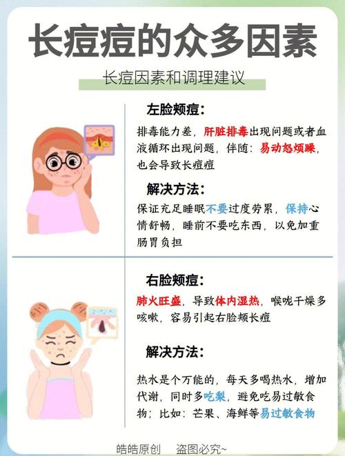 夏天爆痘怎麼辦