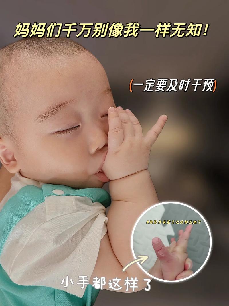 寶寶多大不用綁手