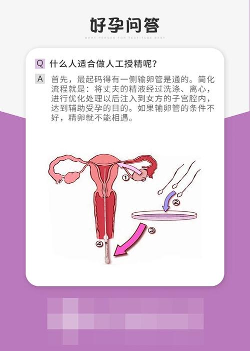 什麼人適合人工受孕