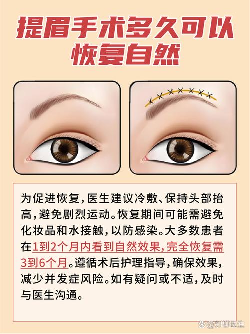 內視鏡提眉維持多久