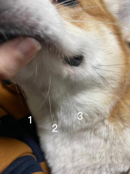 為什麼下巴會長毛
