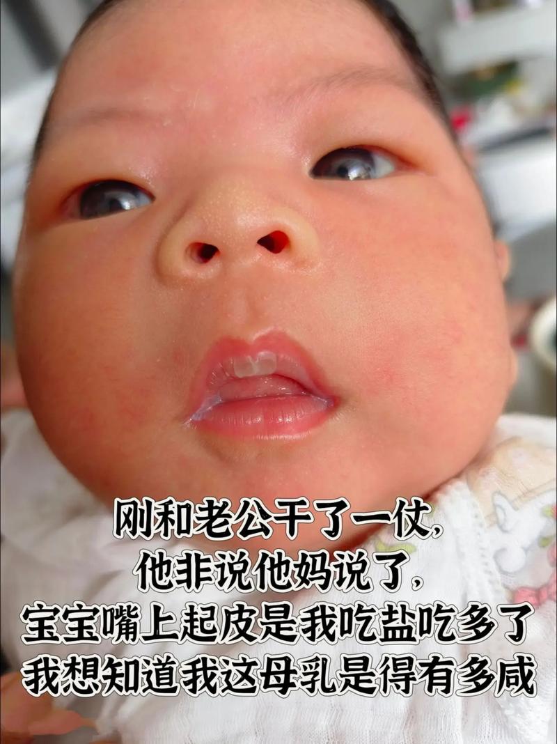 嘴破用鹽巴有用嗎