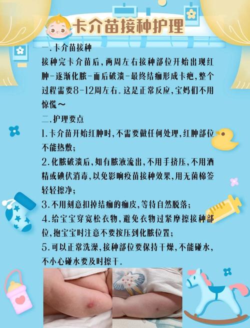 可以不打卡介苗嗎