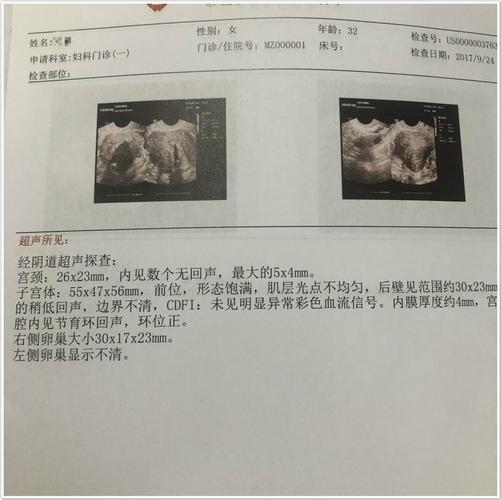 切除子宮可以申請殘障手冊嗎