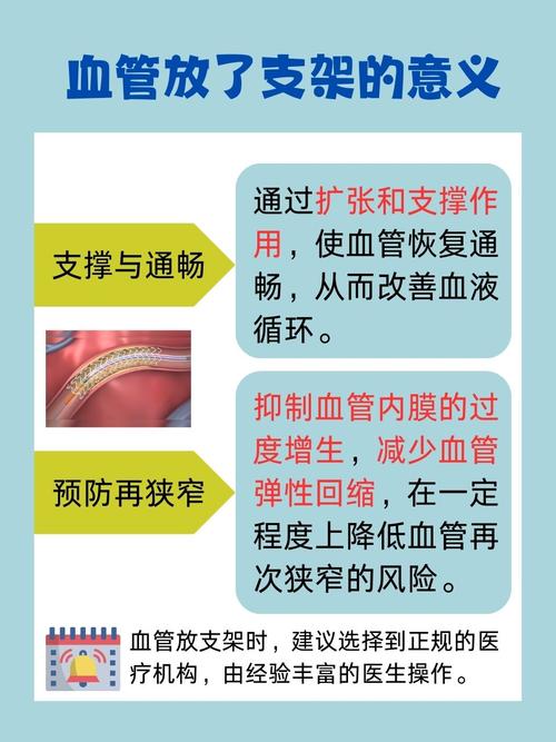裝支架會有後遺症嗎