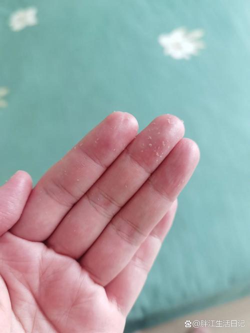 為什麼洗完頭還是黏黏的