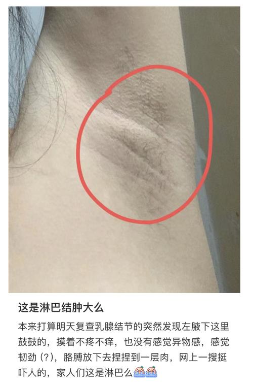 副露是什麼