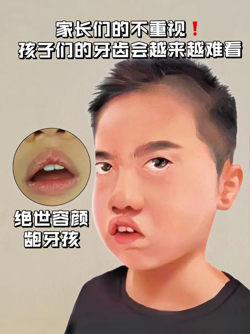 嘴凸是暴牙嗎