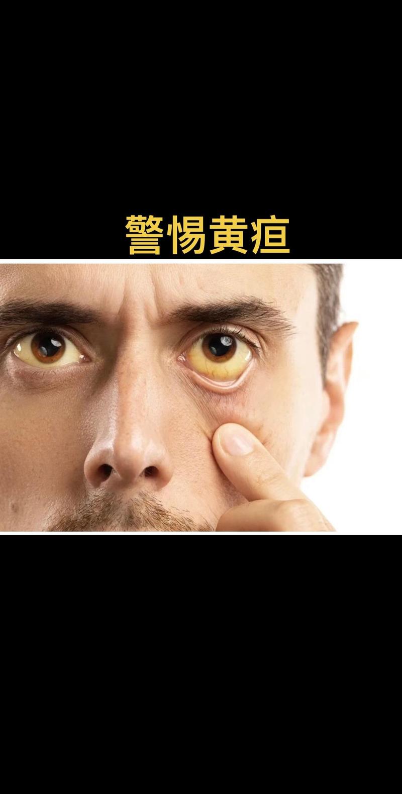怕黑是什麼症狀
