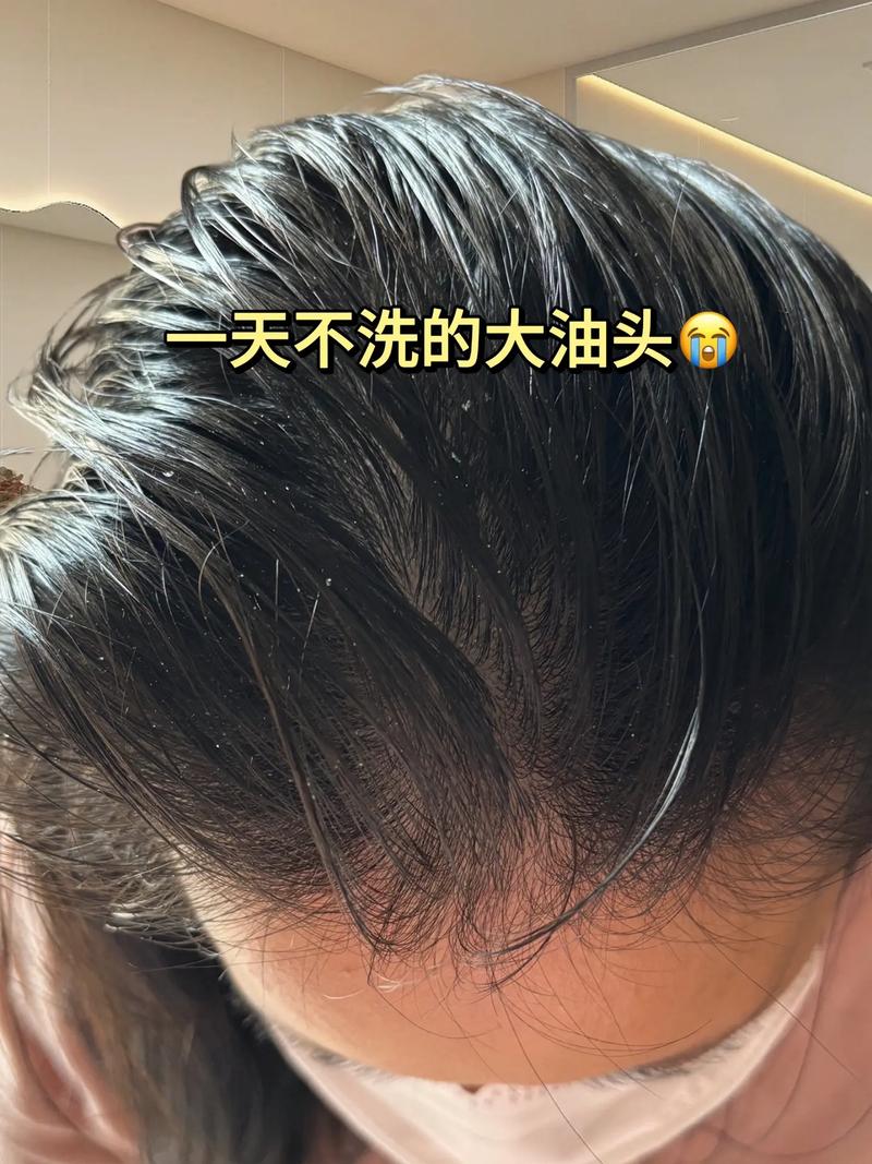 什麼油對頭髮最好