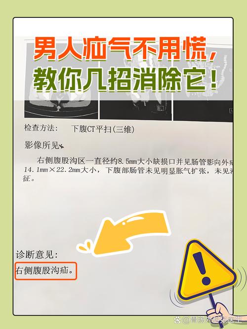 氣結要推開嗎