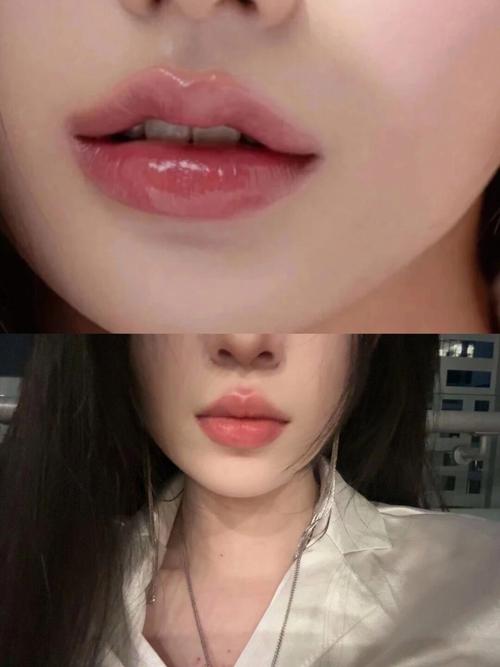 每個人都有唇珠嗎