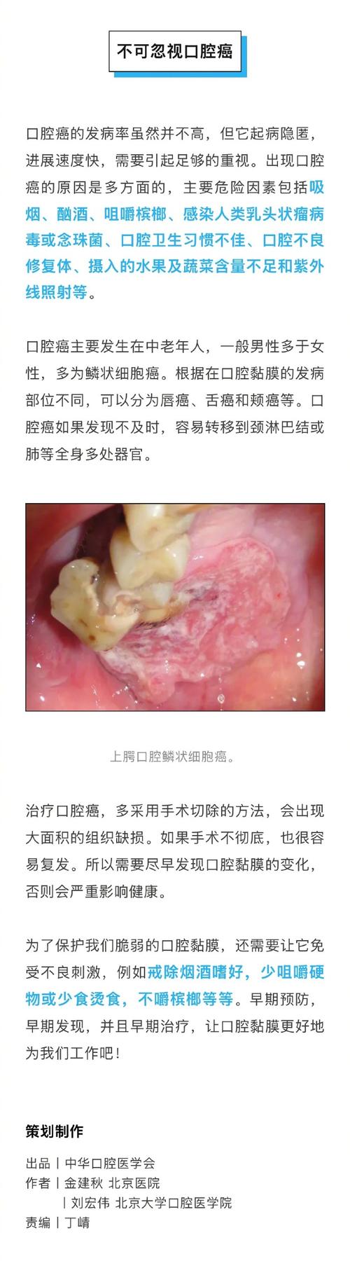 口腔癌會變瘦嗎