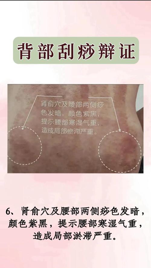 為什麼會出砂